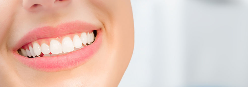 Mundpartie von lächelnder Frau - strahlend weiße Zähne